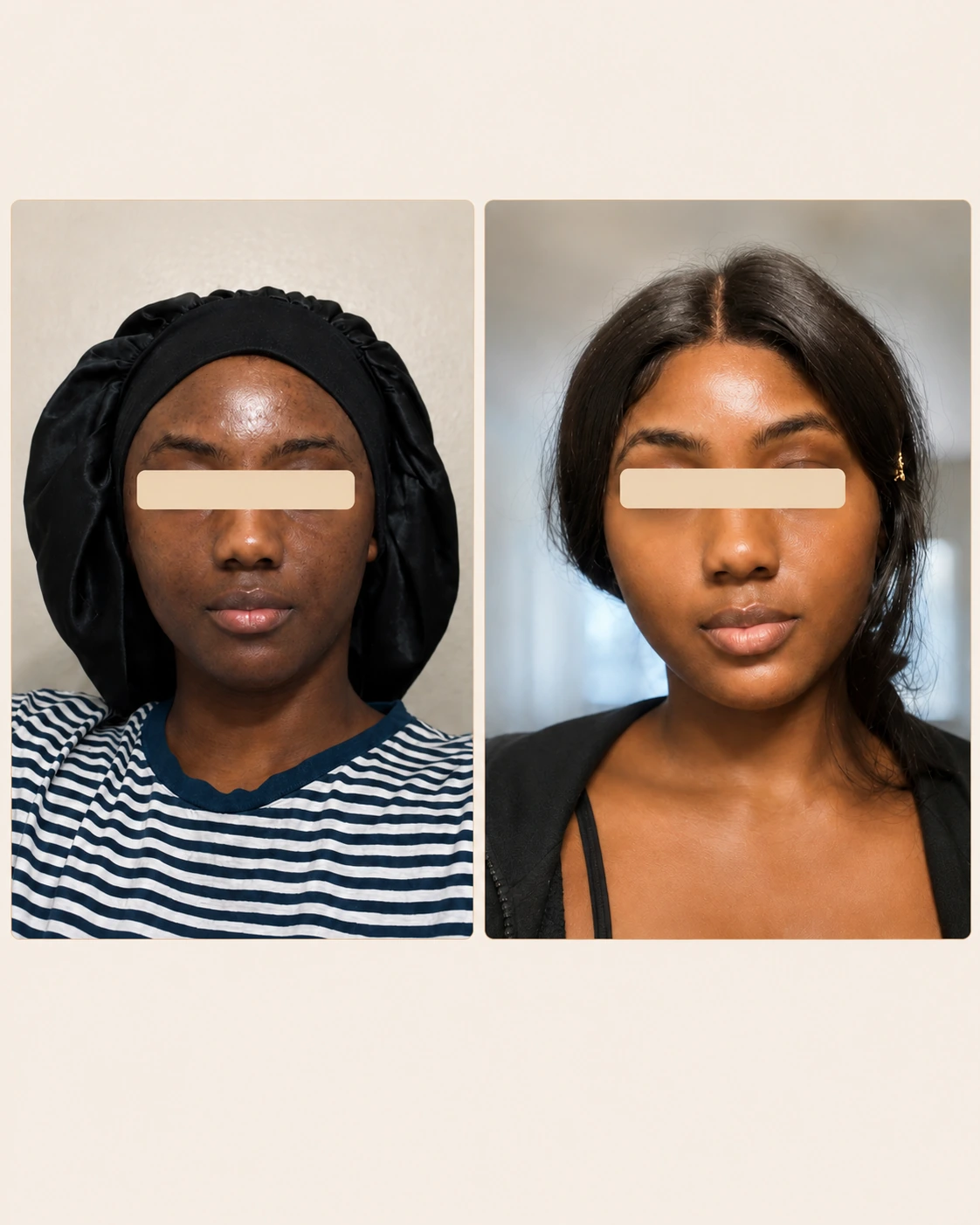Résultat avant-après Maya Cosmétique sur le visage