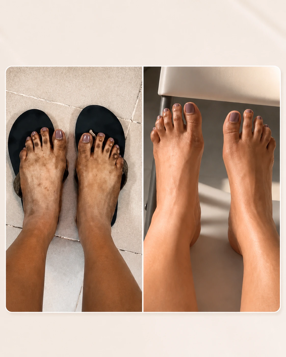 Résultat avant-après Maya Cosmétique sur les pieds