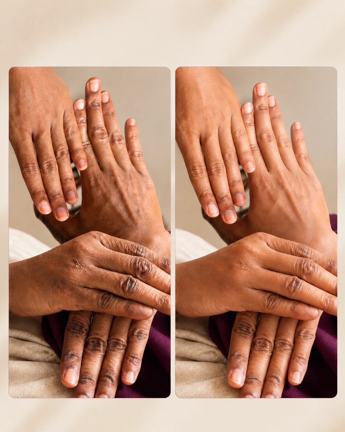 Résultat avant-après Maya Cosmétique sur les mains