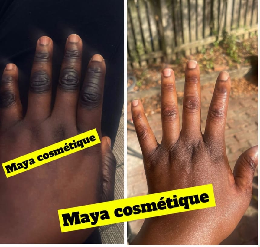 Résultat avant-après Maya Cosmétique sur les mains