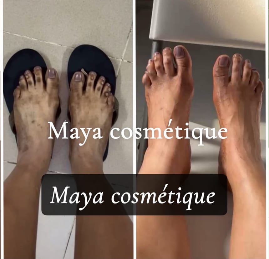 Résultat avant-après Maya Cosmétique sur les pieds